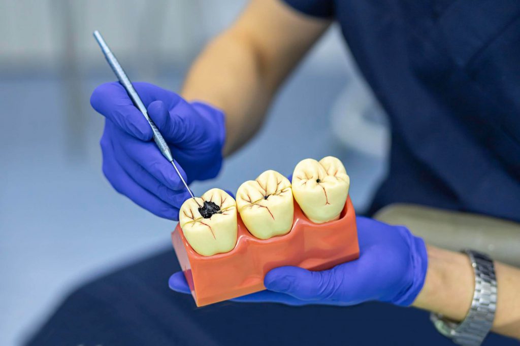 lấy tủy răng có đau không