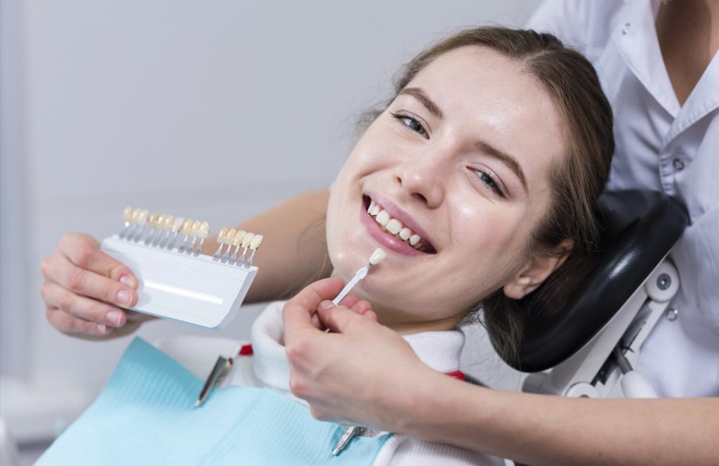 dán sứ veneer giá bao nhiêu