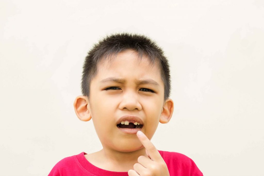 Nhổ răng sữa tại nhà