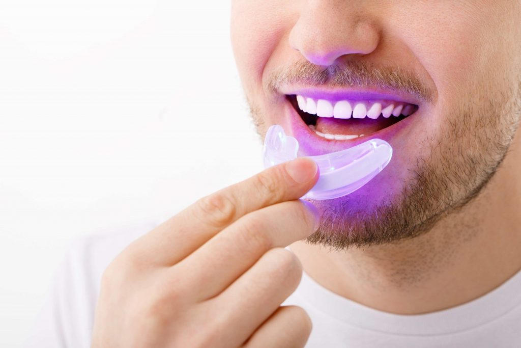 có nên tẩy trắng răng